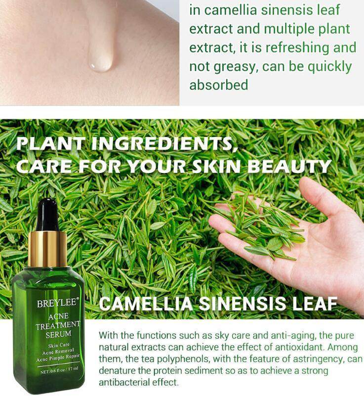 Acne Treatment Serum Facial Repair Oil - Magellan Fashion Shop
