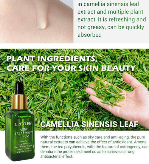 Acne Treatment Serum Facial Repair Oil - Magellan Fashion Shop
