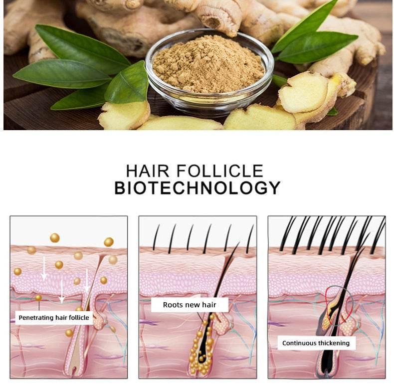 Hair Growth Oil Hair Growth Oil Oem Hair Care Essential Oil - Magellan Fashion Shop