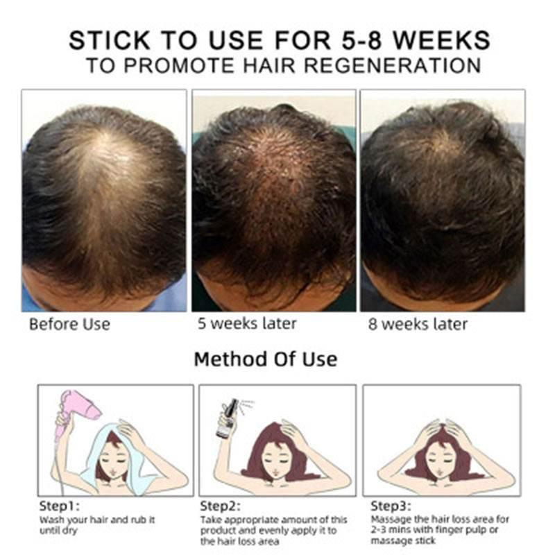 Hair Growth Oil Hair Growth Oil Oem Hair Care Essential Oil - Magellan Fashion Shop