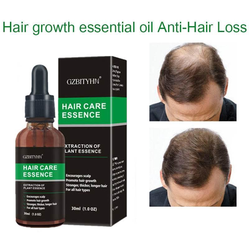 Hair Growth Oil Hair Growth Oil Oem Hair Care Essential Oil - Magellan Fashion Shop