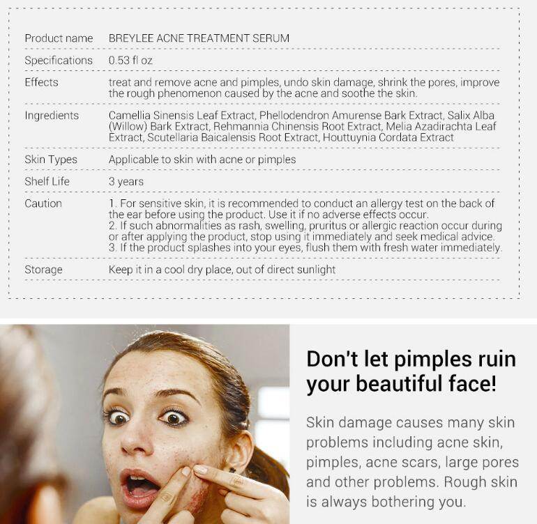 Acne Treatment Serum Facial Repair Oil - Magellan Fashion Shop
