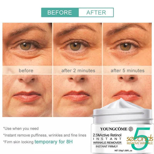 5 Seconds Retinol Anti-Wrinkle Cream Instant Anti Aging Firm - Magellan Fashion Shop