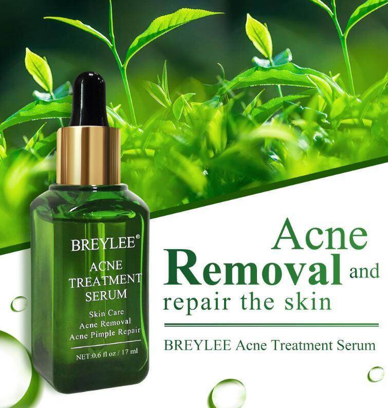 Acne Treatment Serum Facial Repair Oil - Magellan Fashion Shop