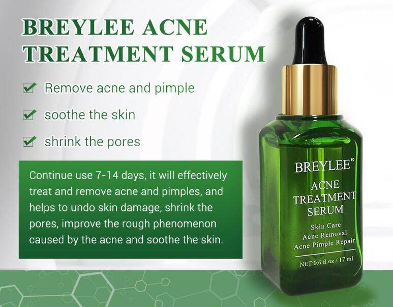 Acne Treatment Serum Facial Repair Oil - Magellan Fashion Shop