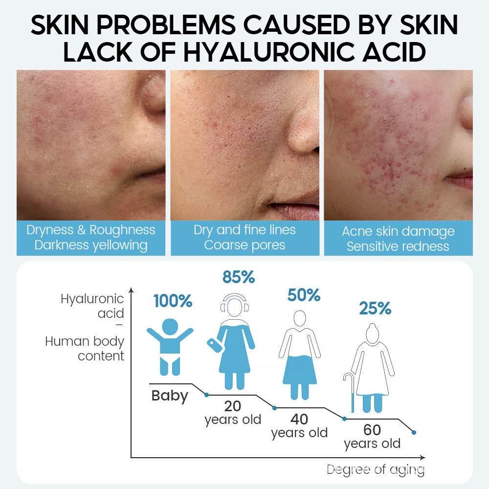 Hyaluronic Acid Face Serum Anti-Aging Shrink Pore Whitening - Magellan Fashion Shop