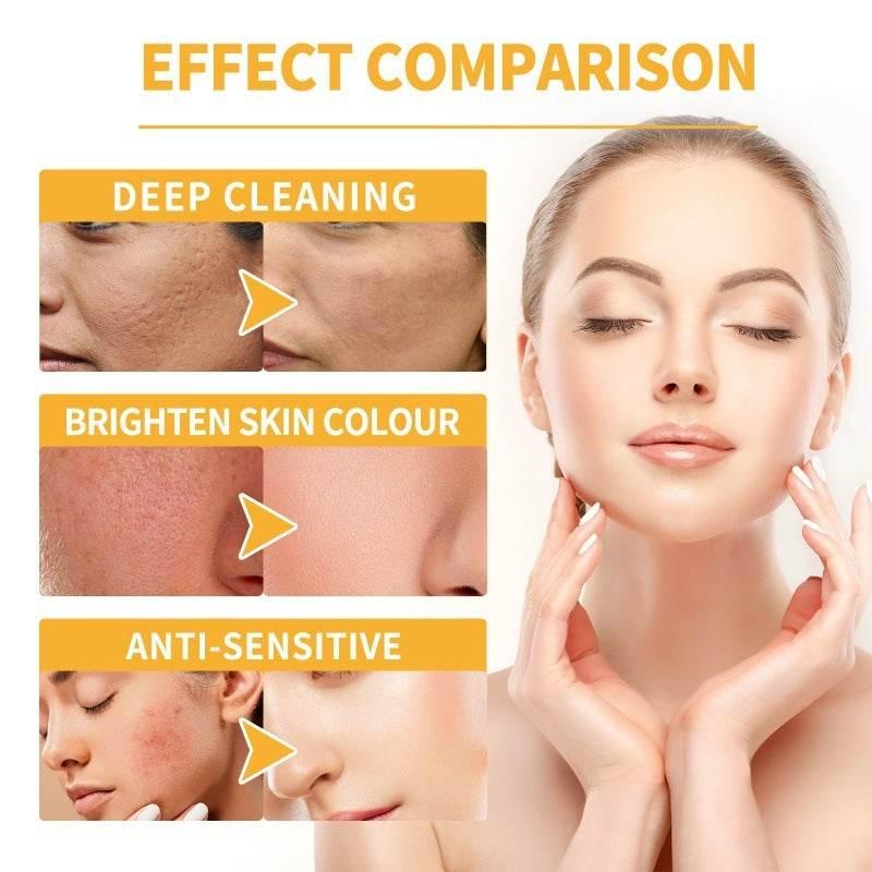 Honey Mask Nourishing Moisturizing Acne Skin Blackhead - Magellan Fashion Shop