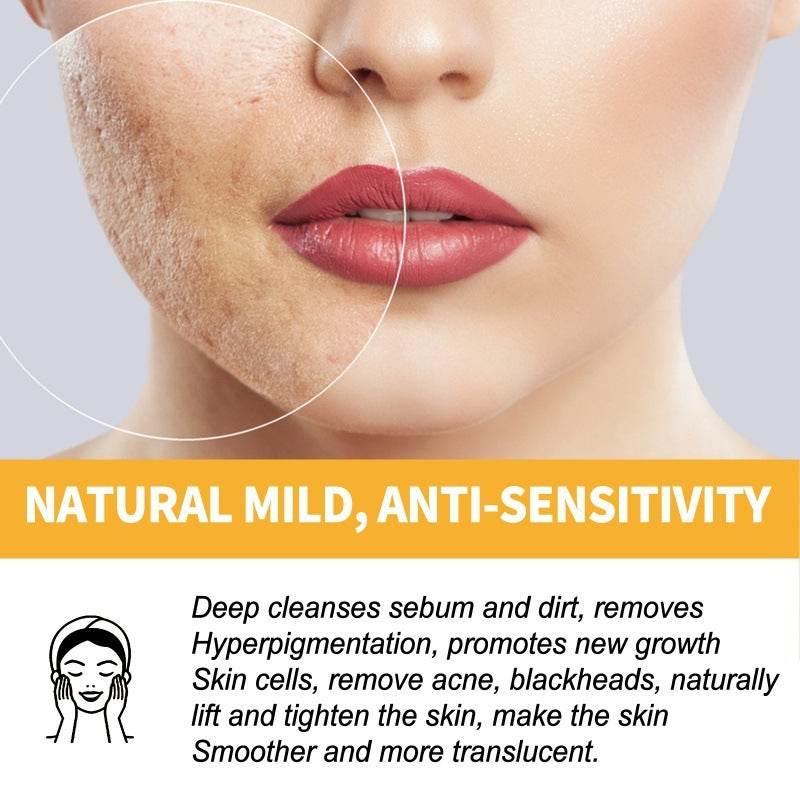 Honey Mask Nourishing Moisturizing Acne Skin Blackhead - Magellan Fashion Shop
