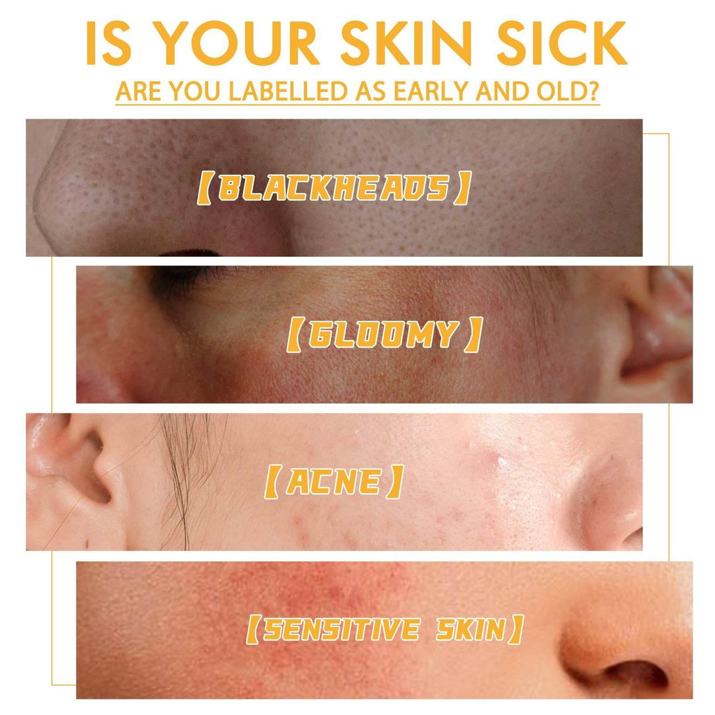 Honey Mask Nourishing Moisturizing Acne Skin Blackhead - Magellan Fashion Shop